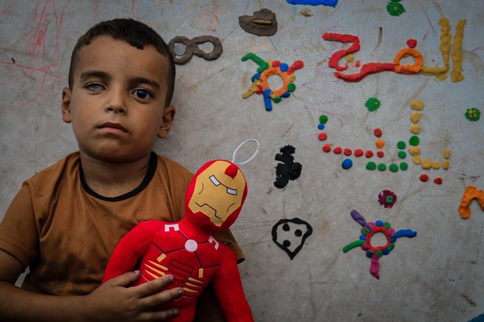 One-Eyed Child’s Art Amid Conflict and Loss