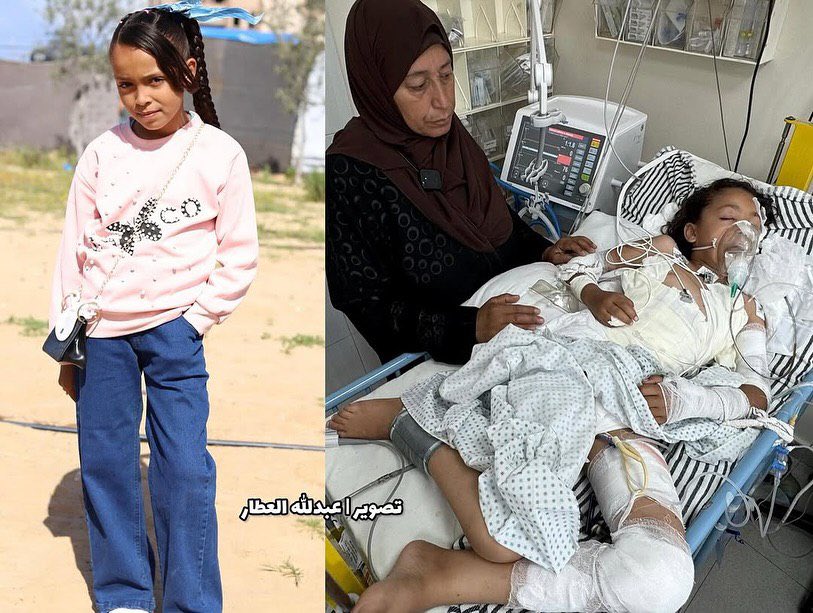 Medical evacuation plea for wounded patient in Khan Younis