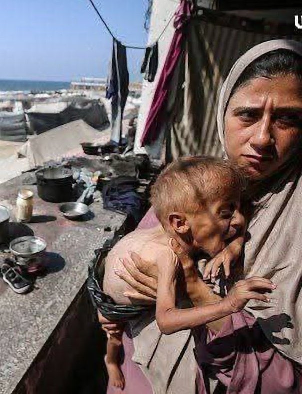 Seven Malnourished Deaths Reported Including Two Children