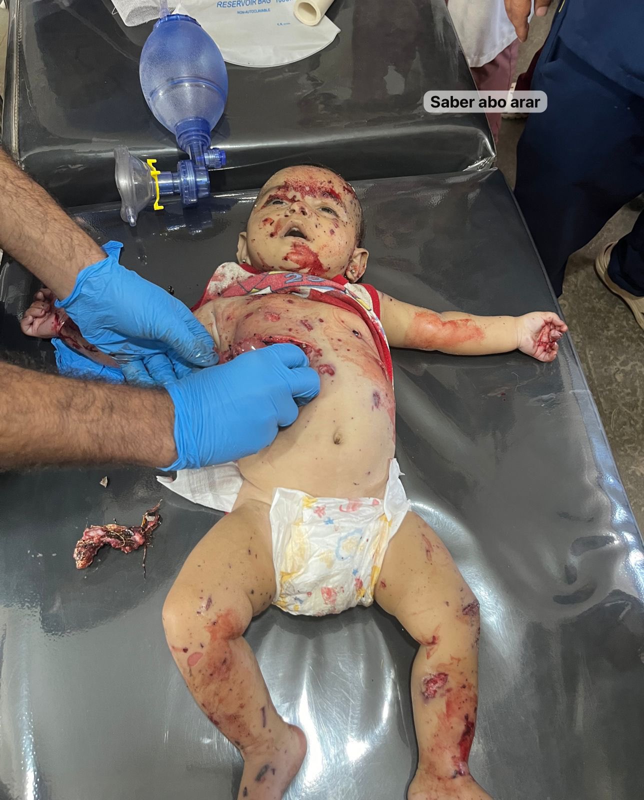 Israeli bombing kills infant in Khan Younis displacement camp