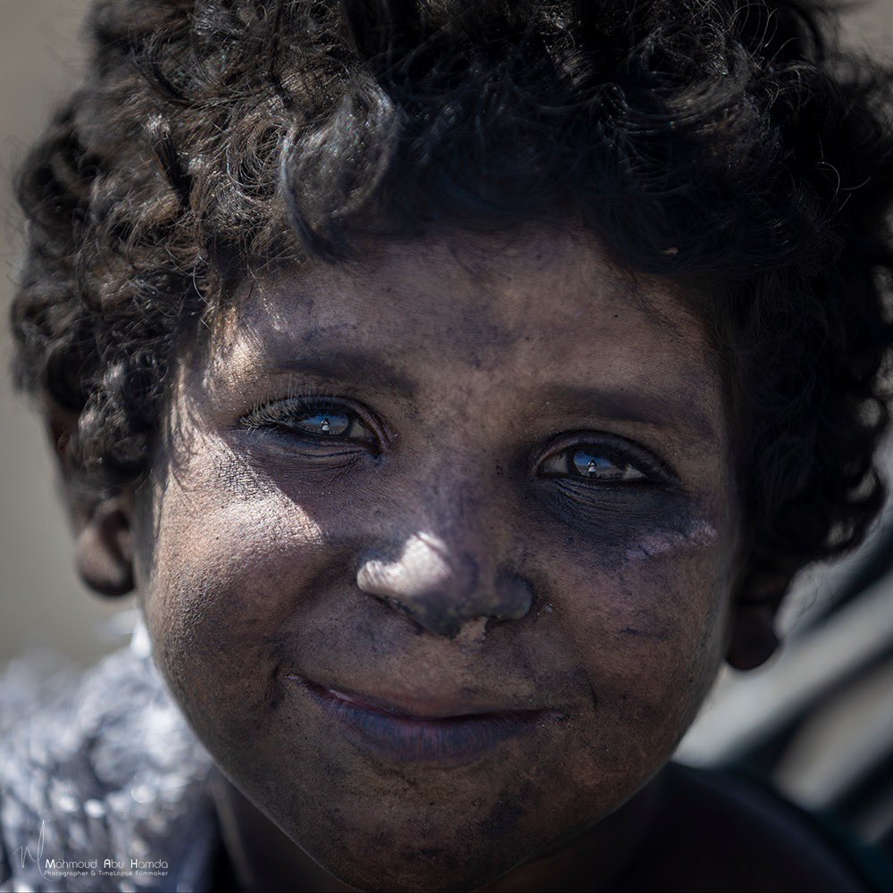 Displaced Child in Gaza Faces Humanitarian Crisis