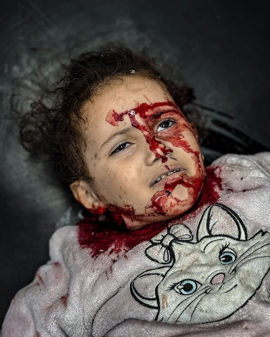 Israeli occupation commits 14 massacres killing 215 in Gaza