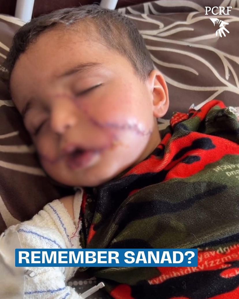 Young Gaza survivor of Israeli airstrike loses family members