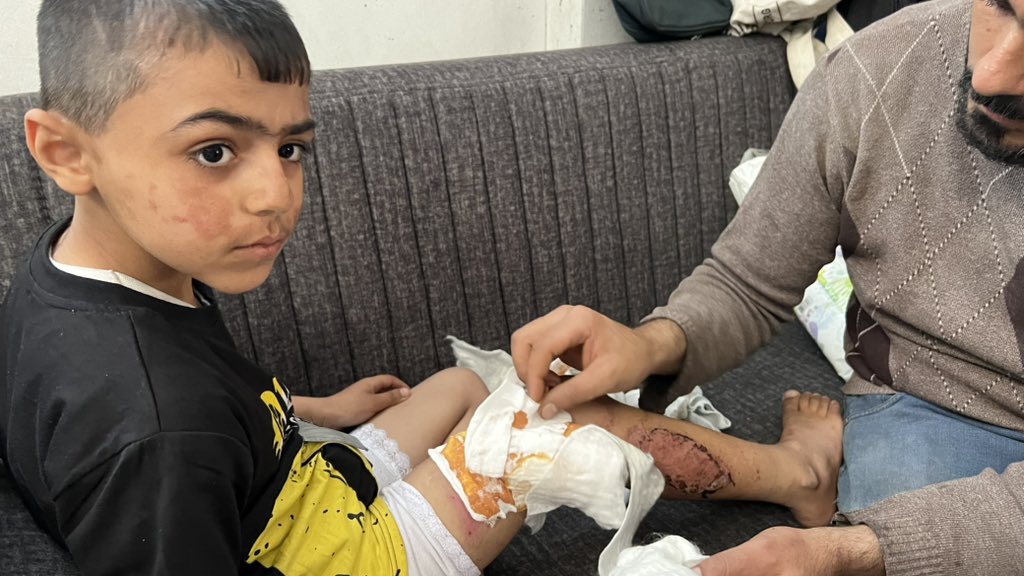Wounded child after family killed in Israeli bombing
