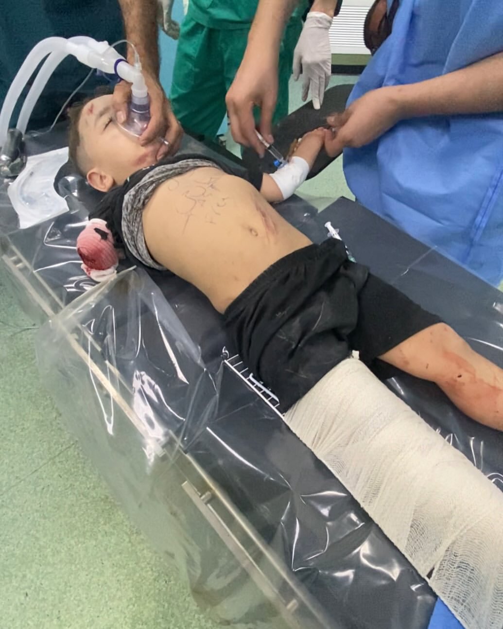 Child critically injured in Israeli airstrike on Gaza City