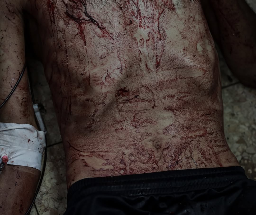 Israeli Forces Fire on Young Man Seeking Aid in Gaza