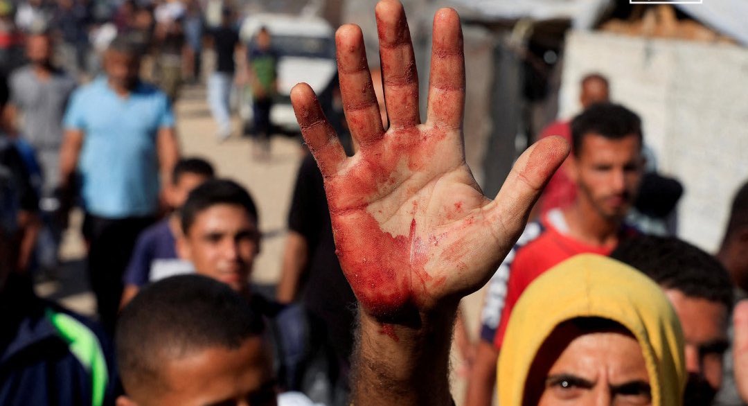 Three Killed, Five Wounded in Gaza City Military Action