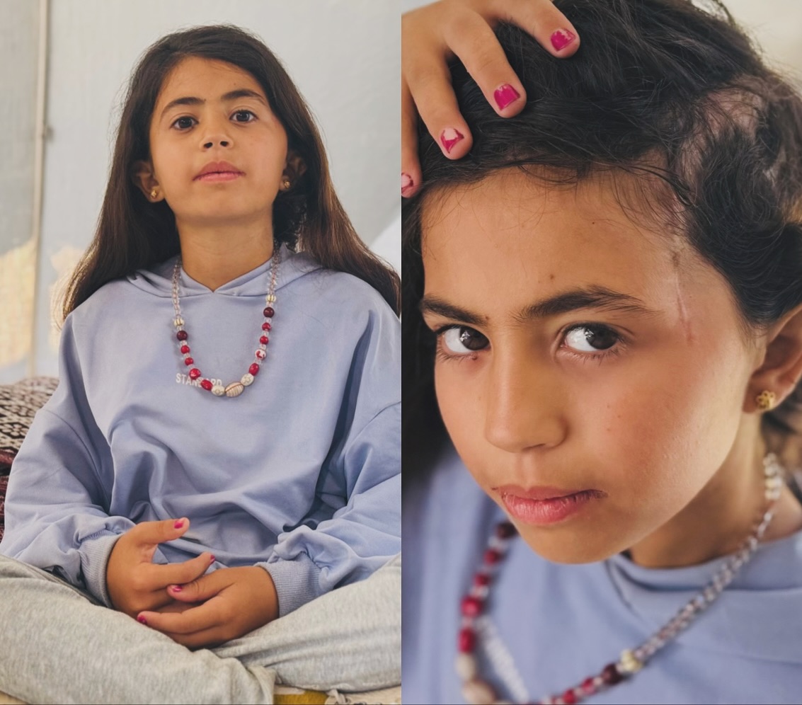 10-Year-Old Girl Injured in Israeli Airstrike on Gaza Displacement Camp