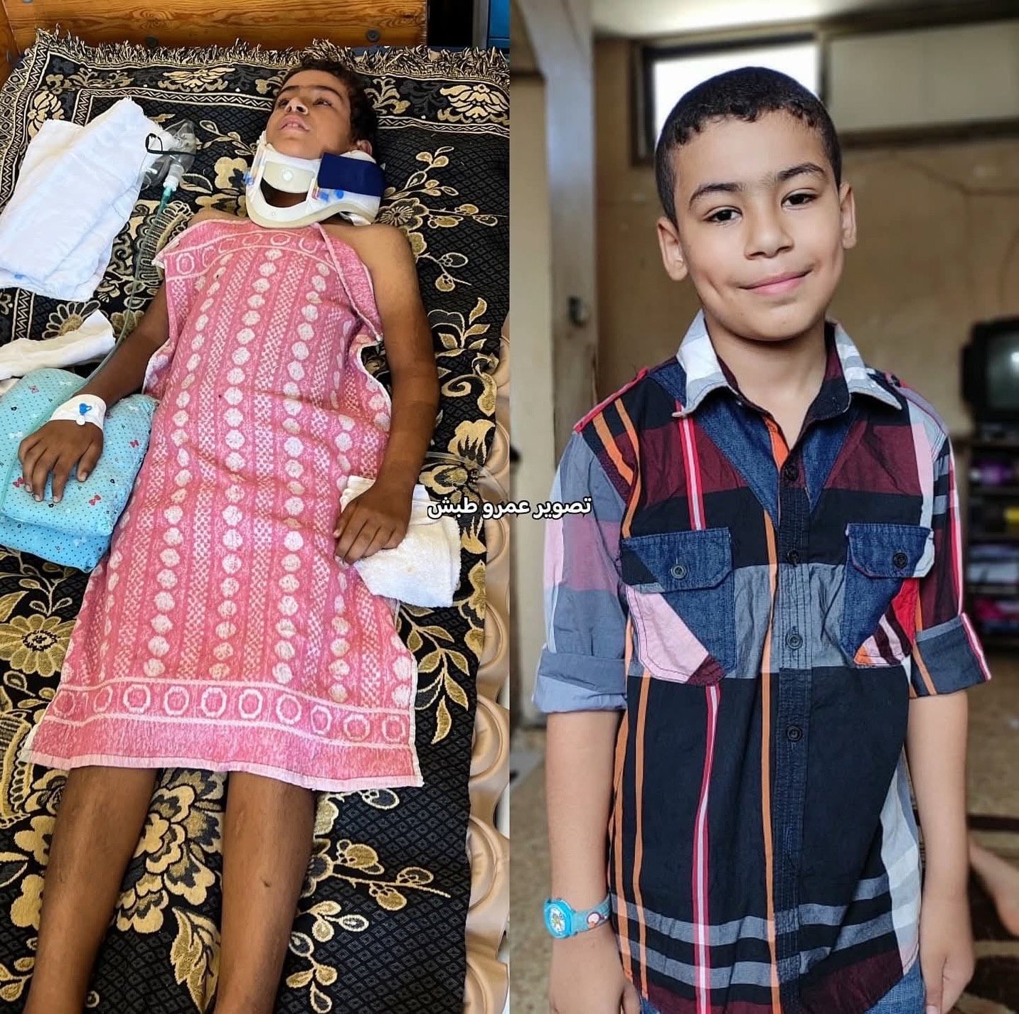 Appeal to Save Paralyzed Child in Gaza