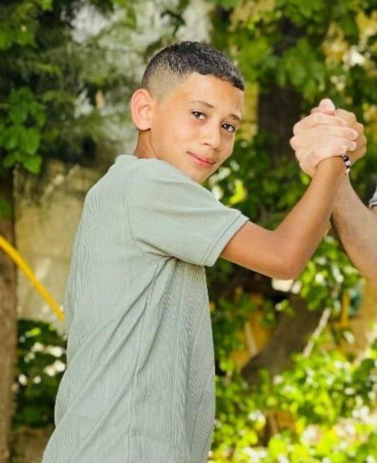 IOF Arrests Wounded 12-Year-Old Child Muhammad Al-Za’aqiq in Beit Ummar