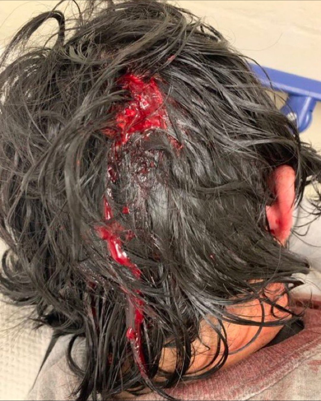 Police Use Rubber Bullets Against UCLA Student Protesters