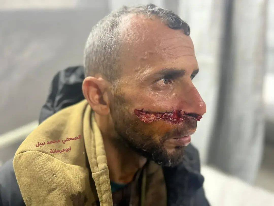Young man injured by live fire in Rafah’s Mawasi area
