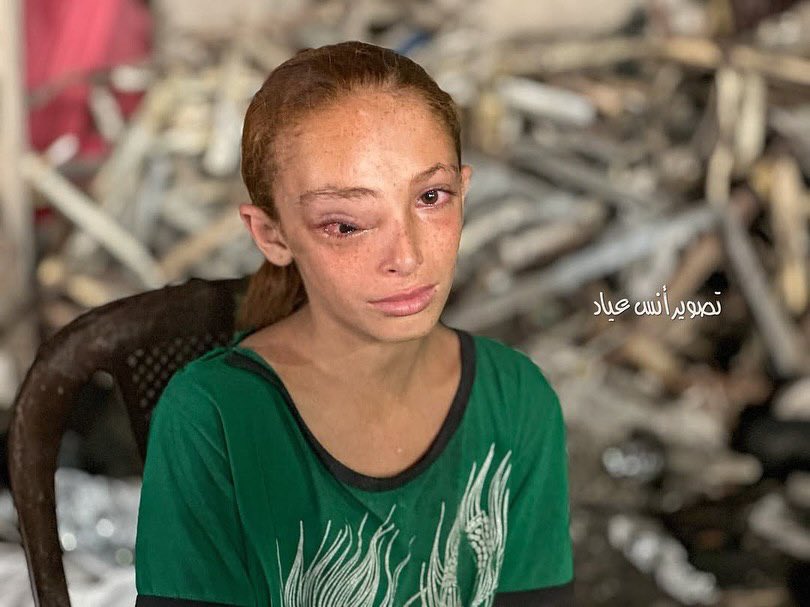 Child cancer patient Sarah needs urgent medical help Gaza