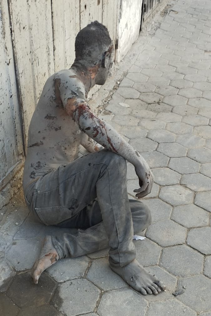 Israeli bombing wounds several people in Al Nuseirat refugee camp