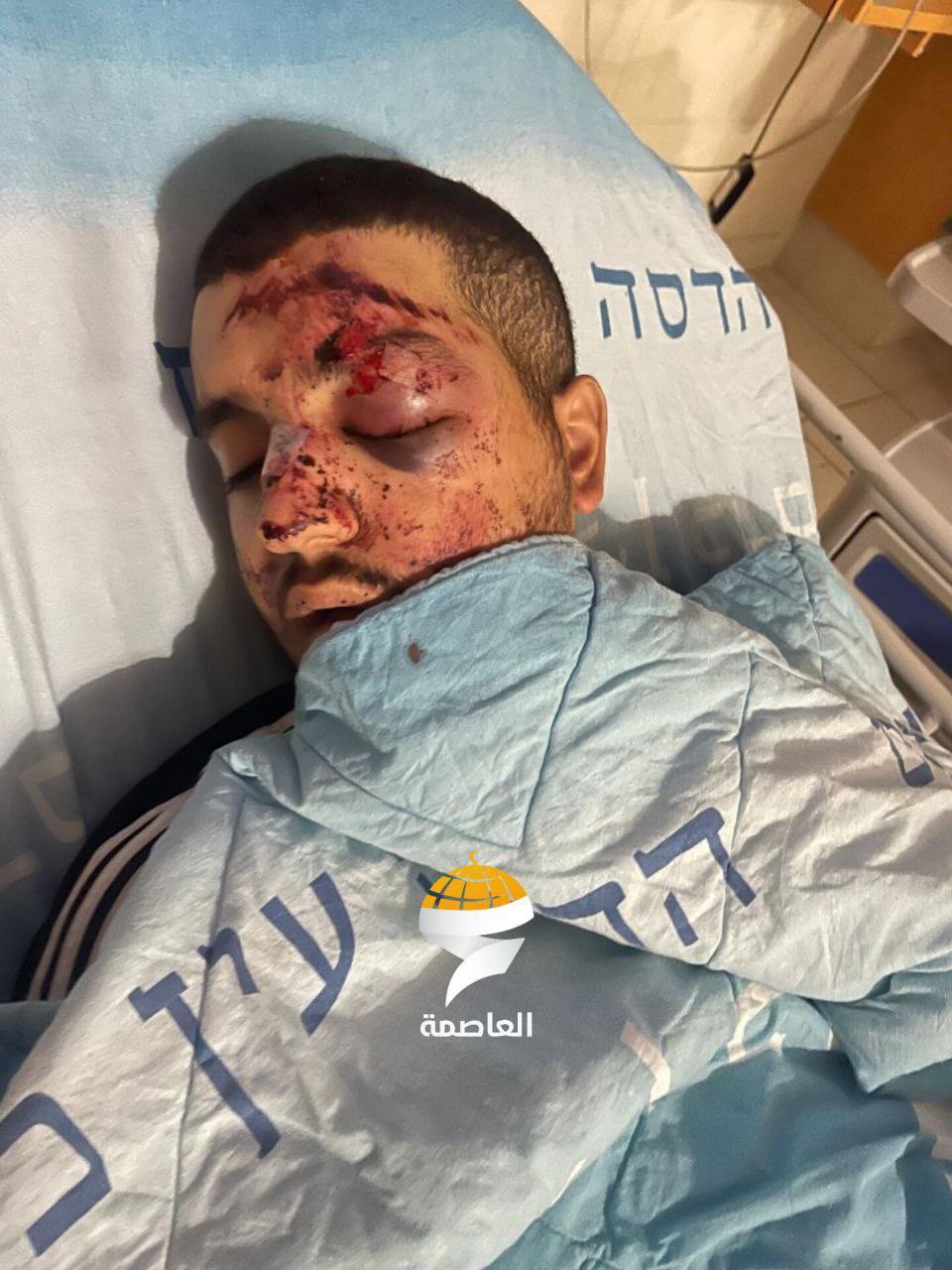 Israeli forces assault Palestinian youth in Jerusalem