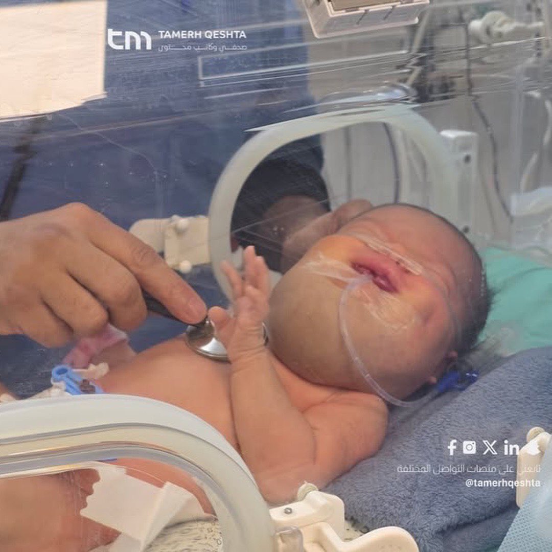 Infant at Nasser Hospital urgently needs medical referral abroad