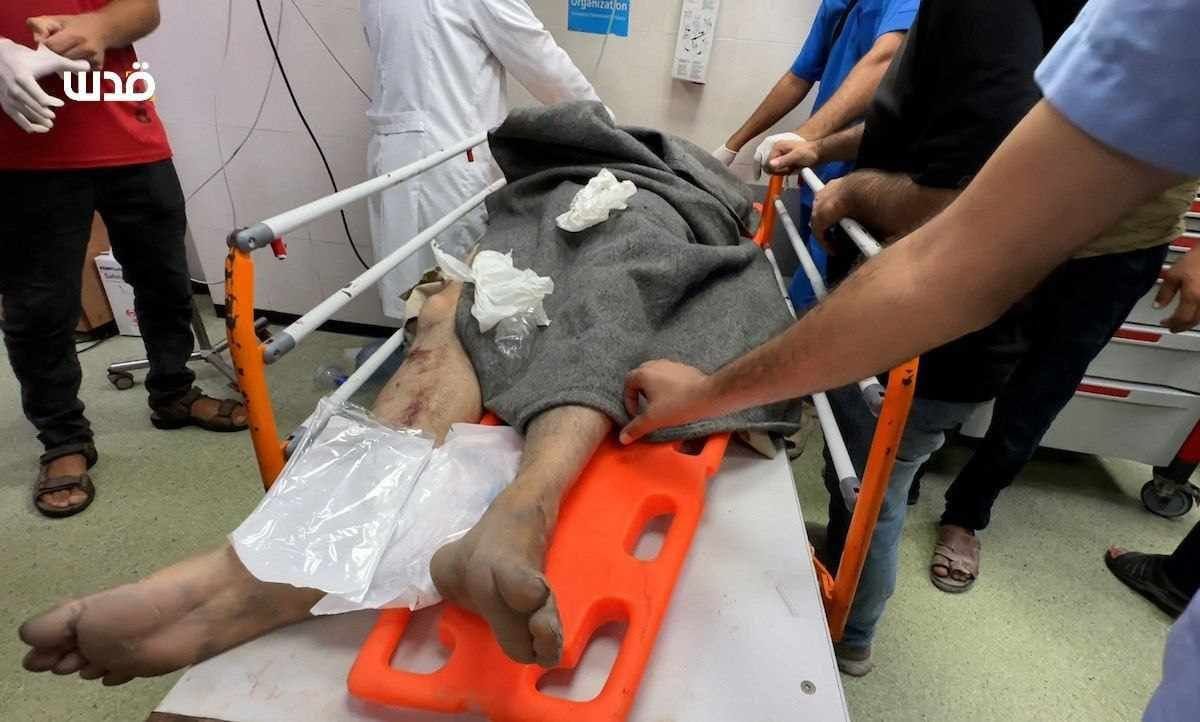 Israeli bombardment causes injuries in Khan Younis eastern areas