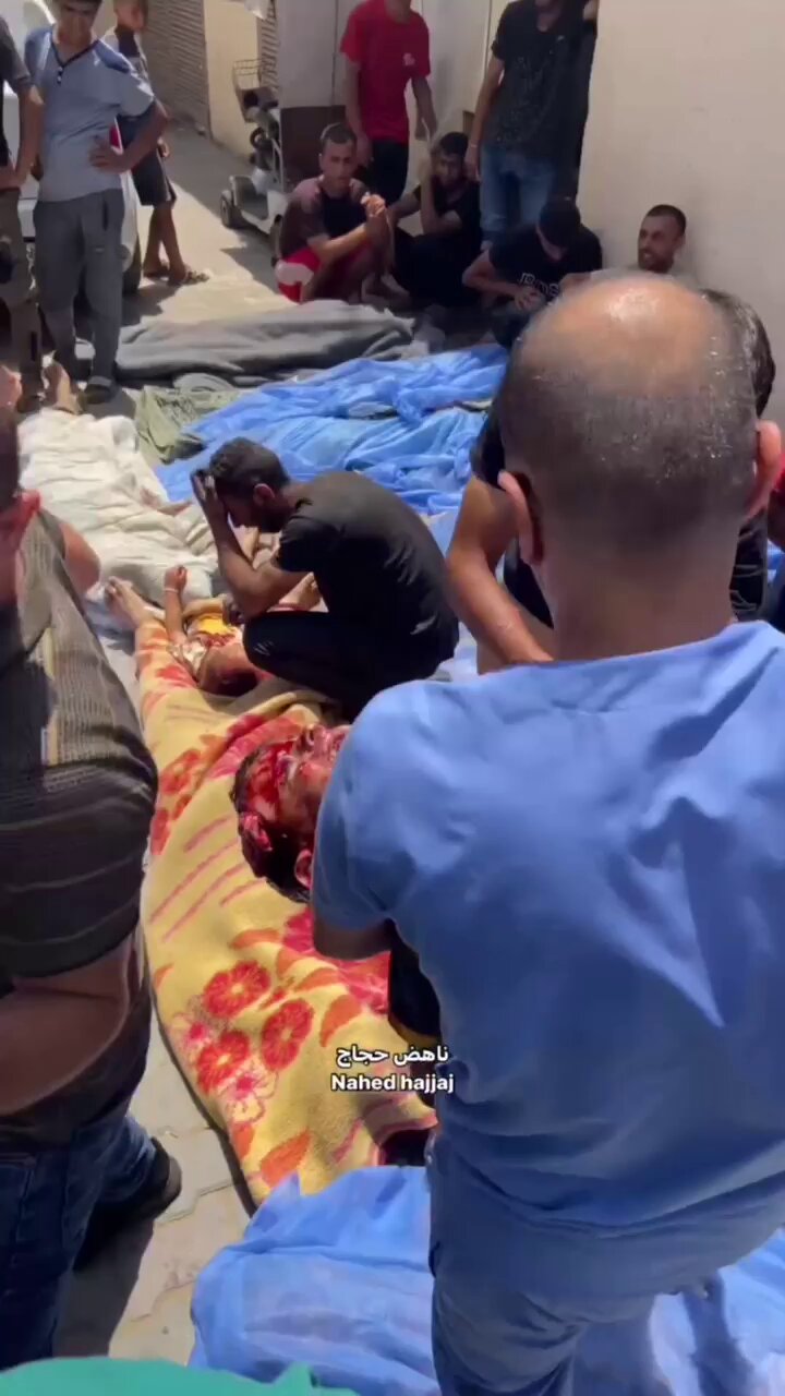 Child Tawfia survives Nuseirat massacre, treated in intensive care