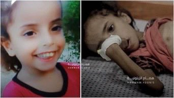 Child malnutrition: genetic disease or starvation from occupation