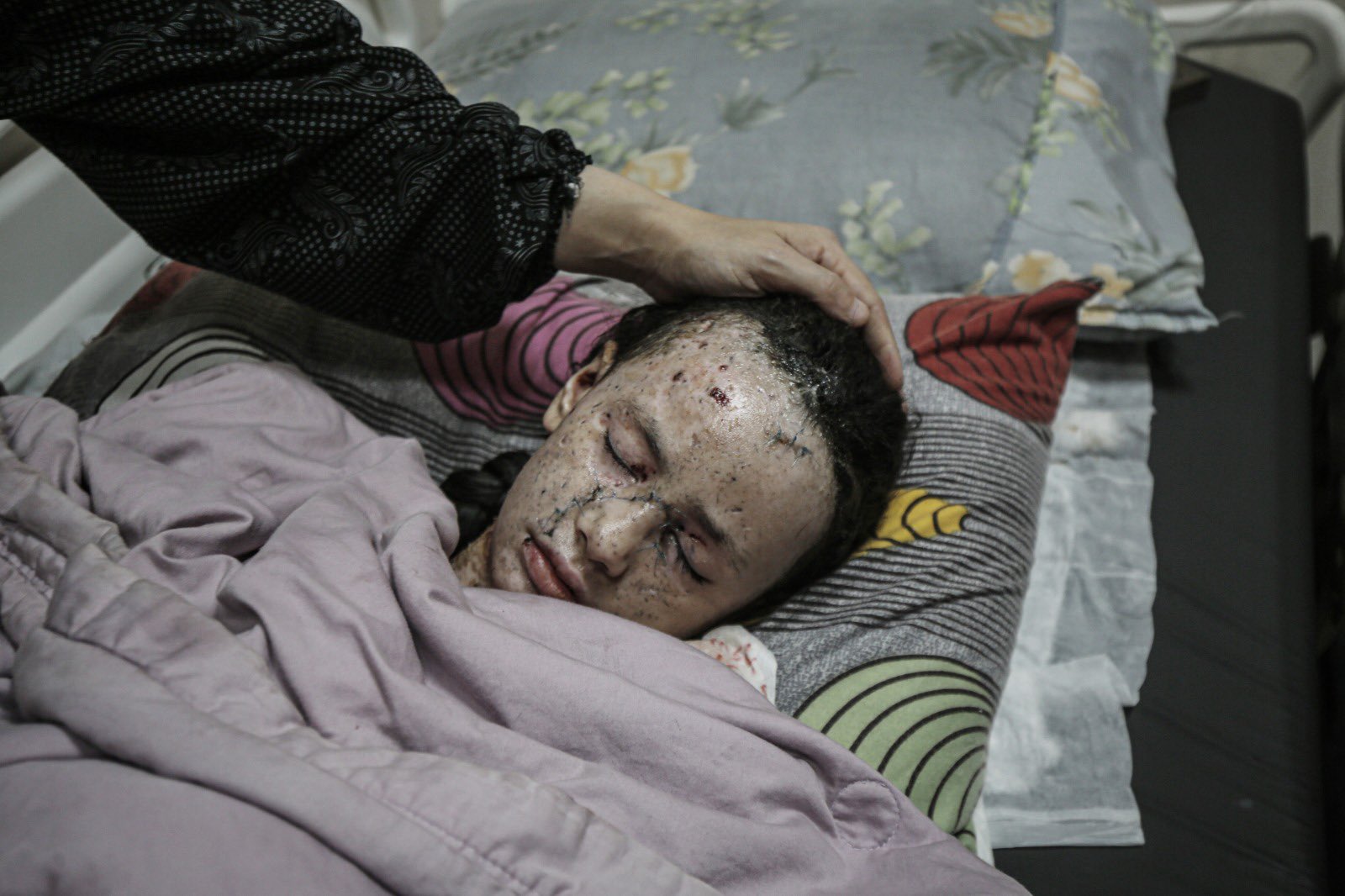 Child Injured in Israeli Bombing of Gaza Refugee Camp