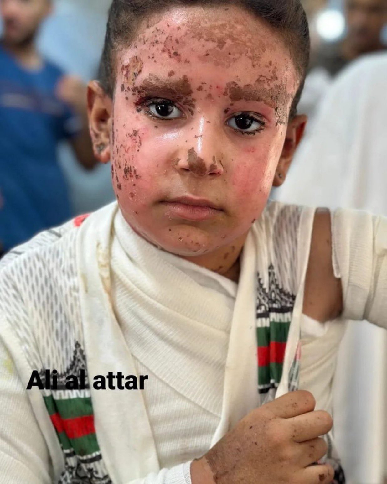 Child survivor of airstrike in Khan Younis loses family