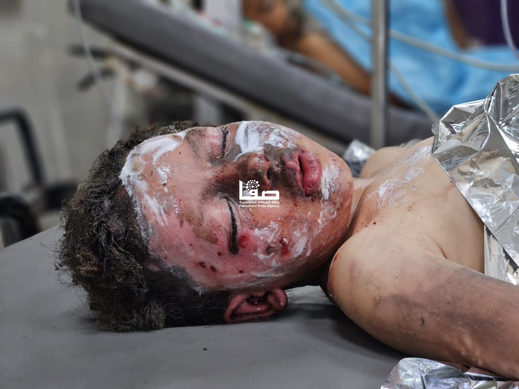 Israeli bombing in Al Mawasi kills child, wounds several others