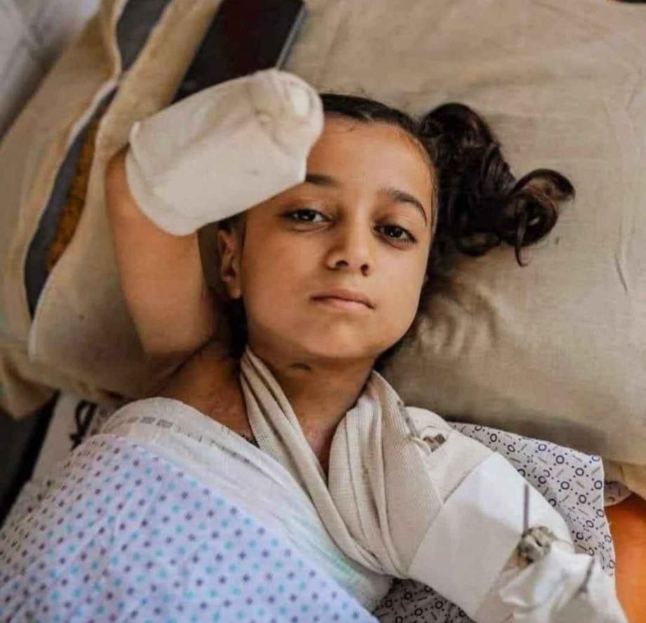 Disability cases surge in Gaza since October 2023