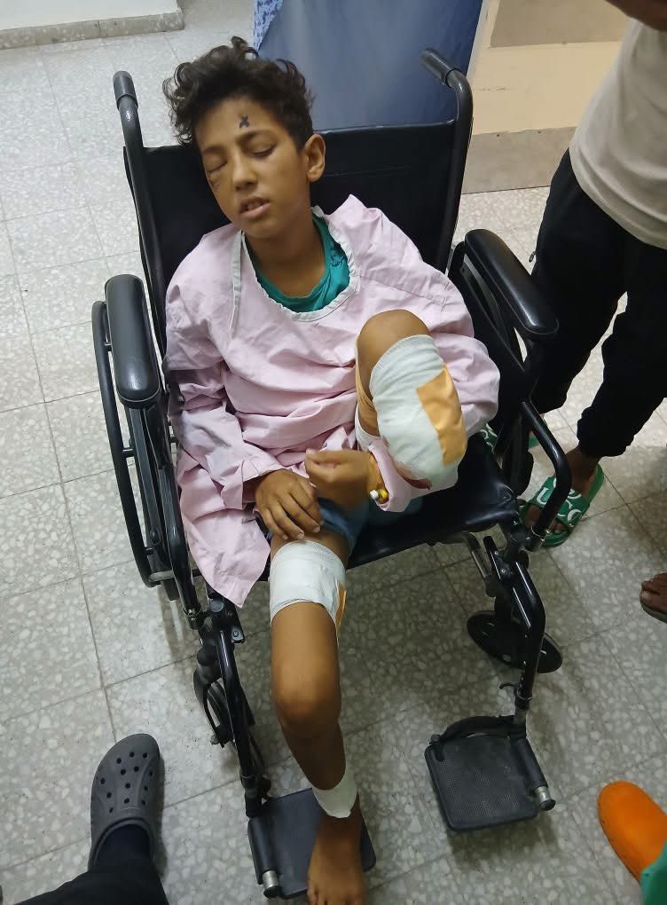 13-Year-Old Gaza Survivor Needs Urgent Eye Surgery After Airstrike