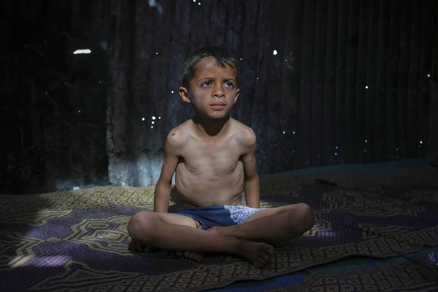 Gaza faces critical protein and dairy shortage amid rising malnutrition crisis