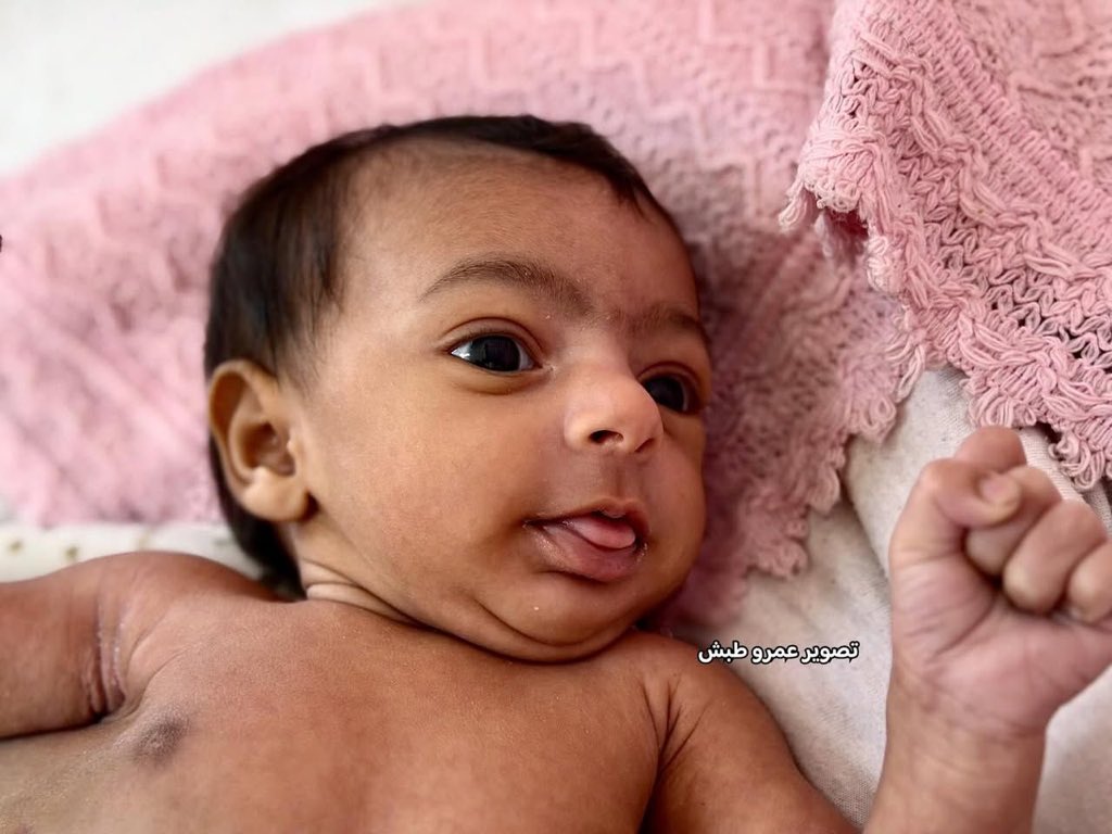 Infant Medical Emergency and Rafah Crossing Closure in Gaza