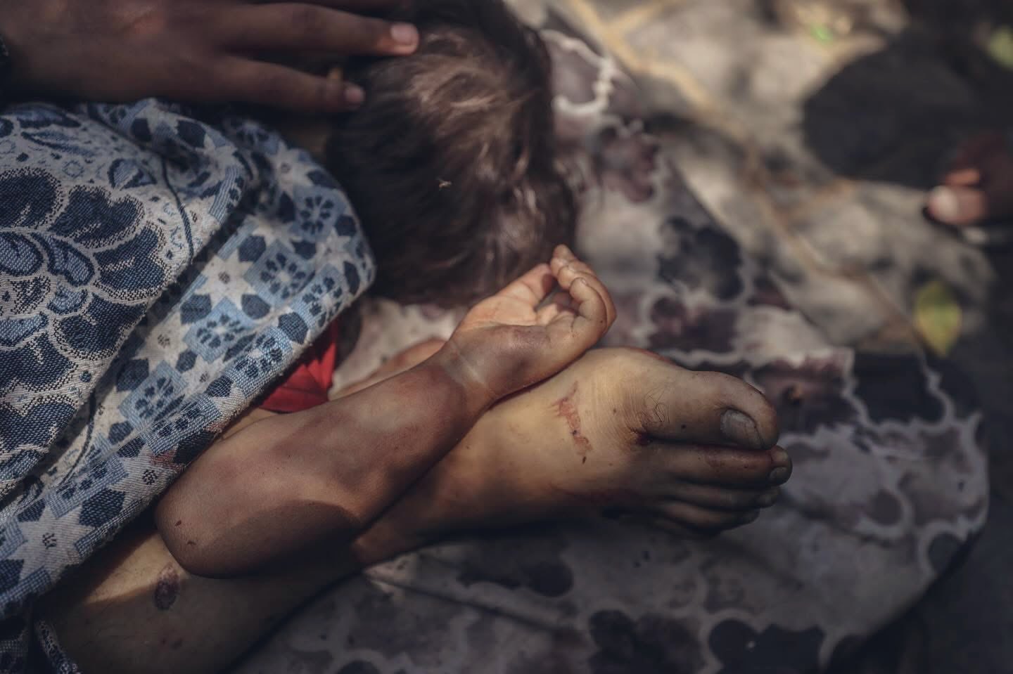 Child Killed in Israeli Strike on Displacement Tents Gaza