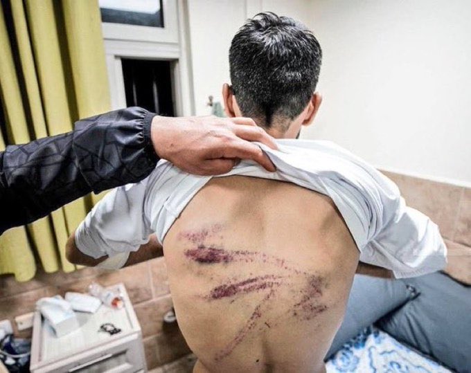 Hospital Director Documents Torture Signs in Released Detainees