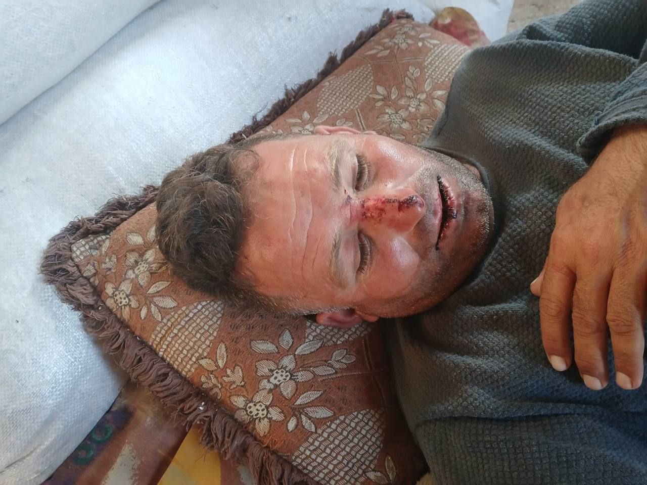 Israeli settlers assault Palestinian family near Nablus steal sheep