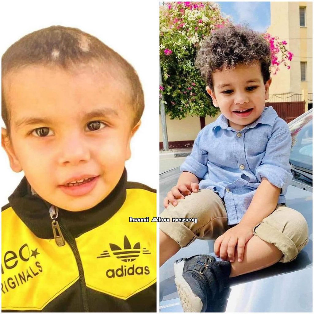 Palestinian Child Critically Injured in Israeli Airstrike Needs Medical Care