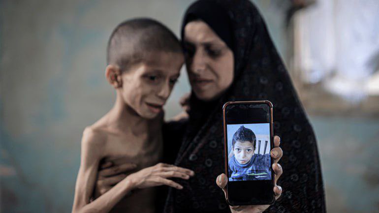 Death toll and child vulnerability in conflict zone