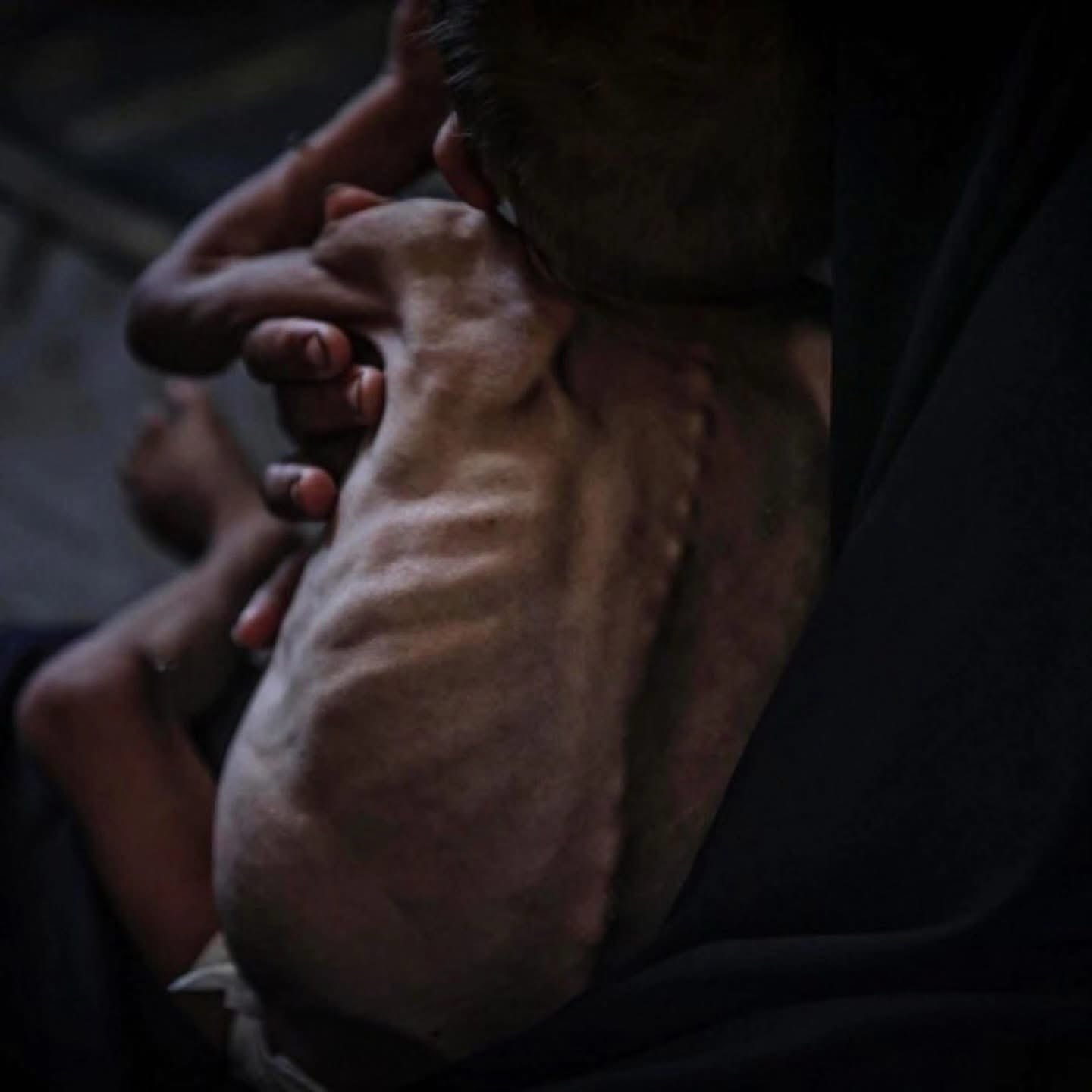 Gaza ceasefire blocking food is managed starvation genocide