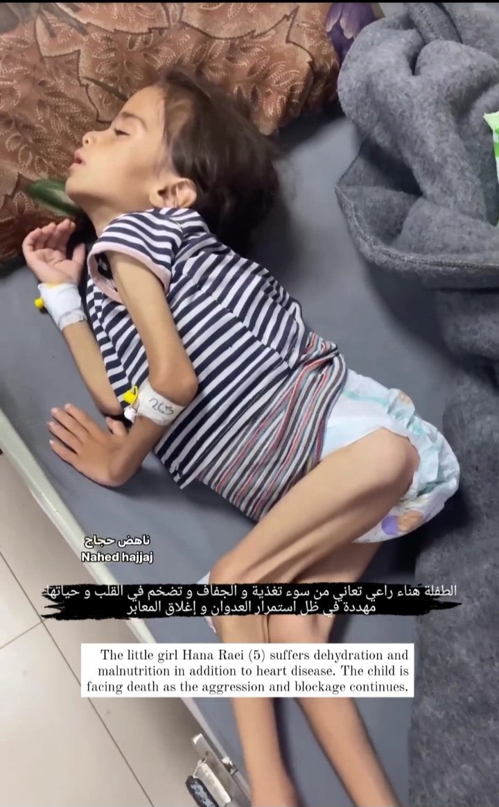 Israeli blockade causing starvation in Gaza
