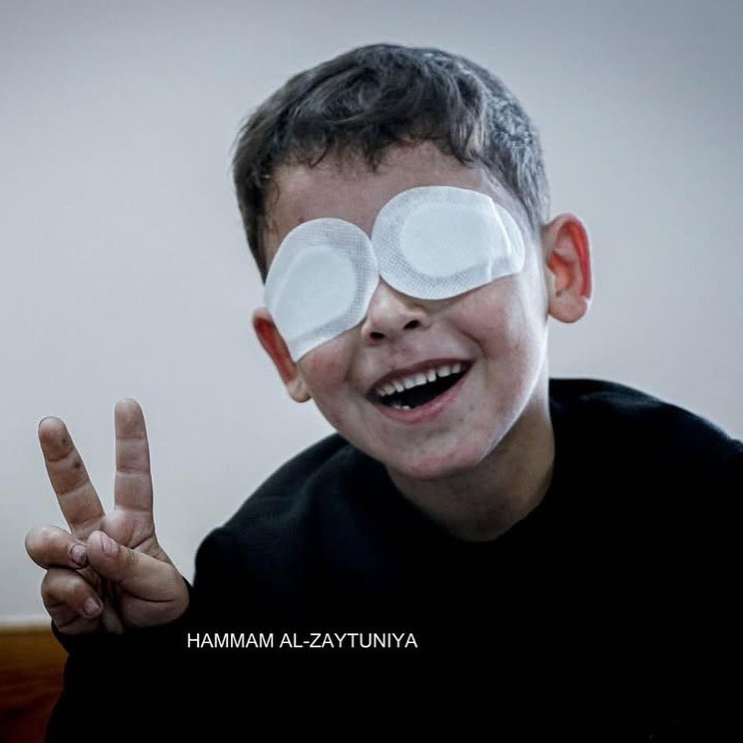 Child Ahmed Hejazi Loses Sight in Gaza War