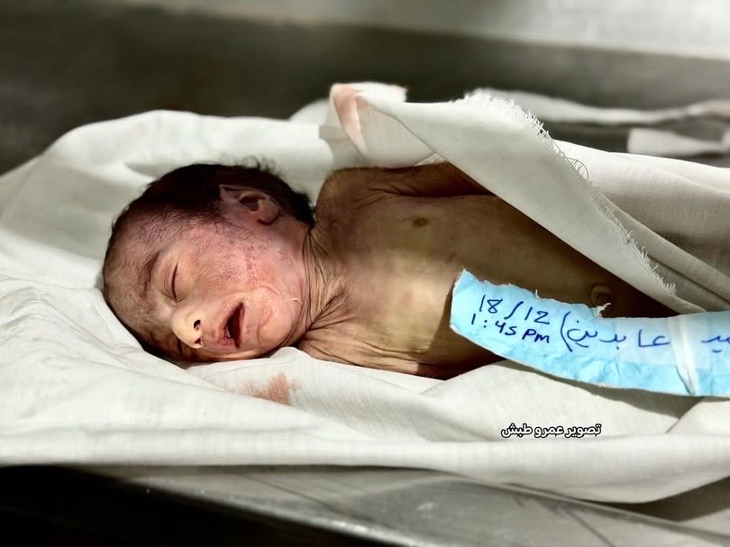 One-month-old infant dies of hypothermia during Gaza cold wave