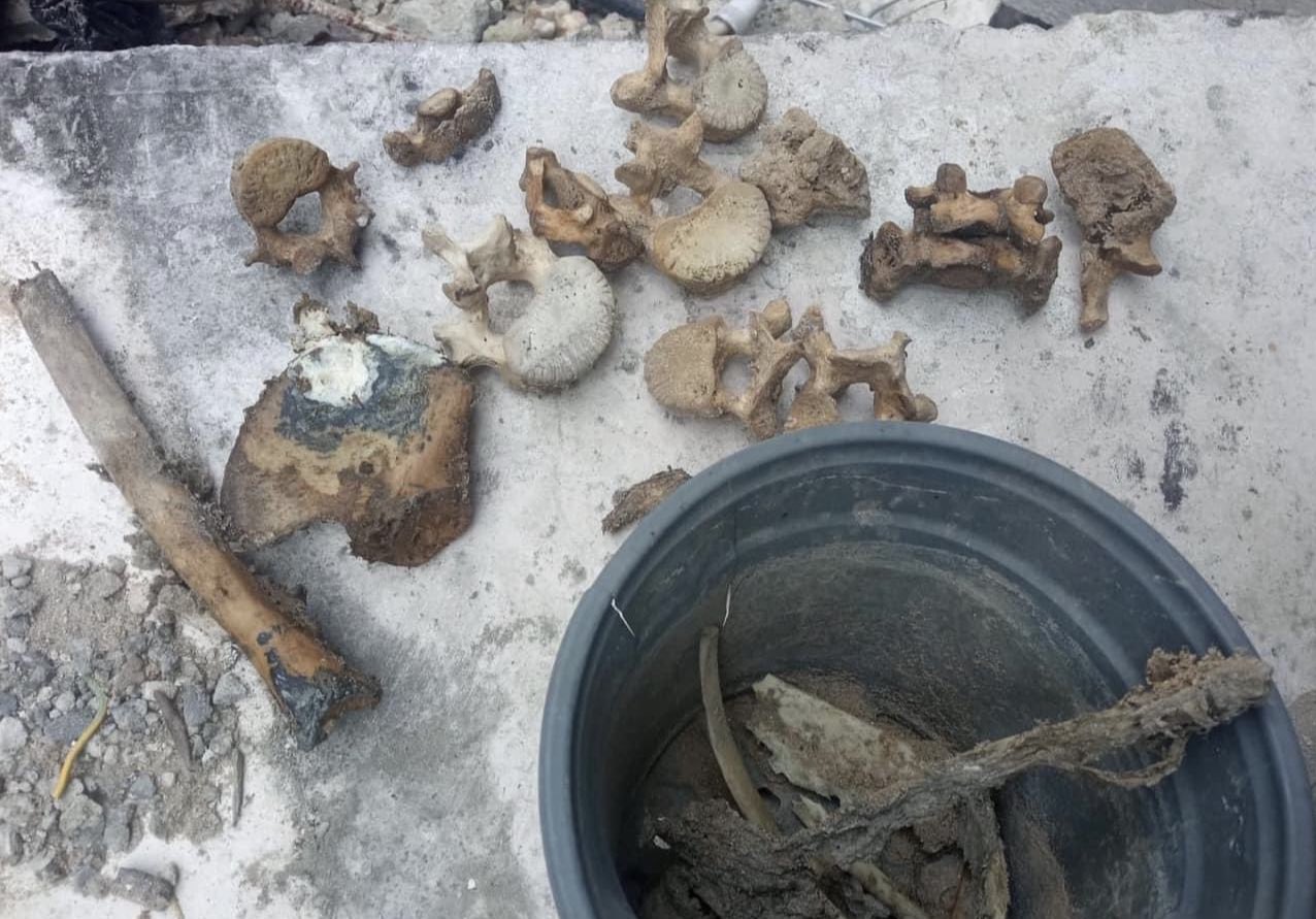 Gaza Father Shows Remains of 6 Siblings and Wife After 88 Days