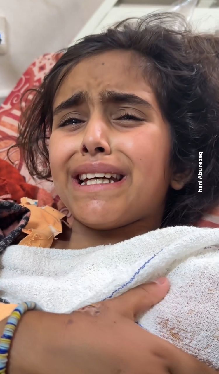 Palestinian Girl Loses Hand in Israeli Airstrike