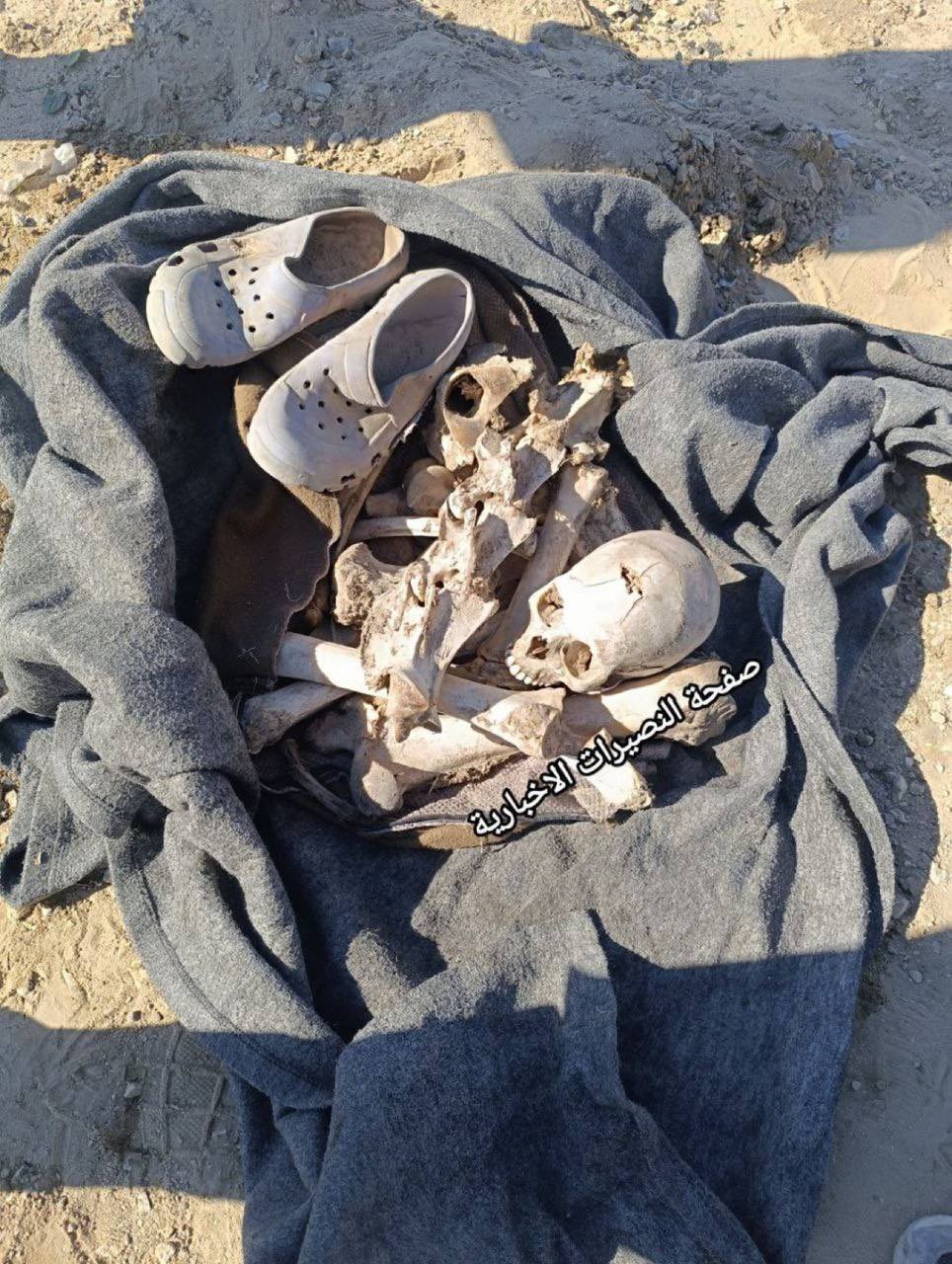 Gaza Hospital Casualty Report: 63 Bodies Arrived