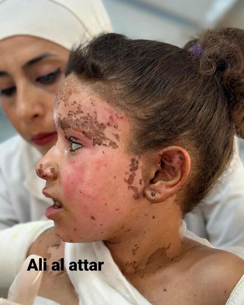 Sole survivor of family killed in Israeli airstrike Khan Younis