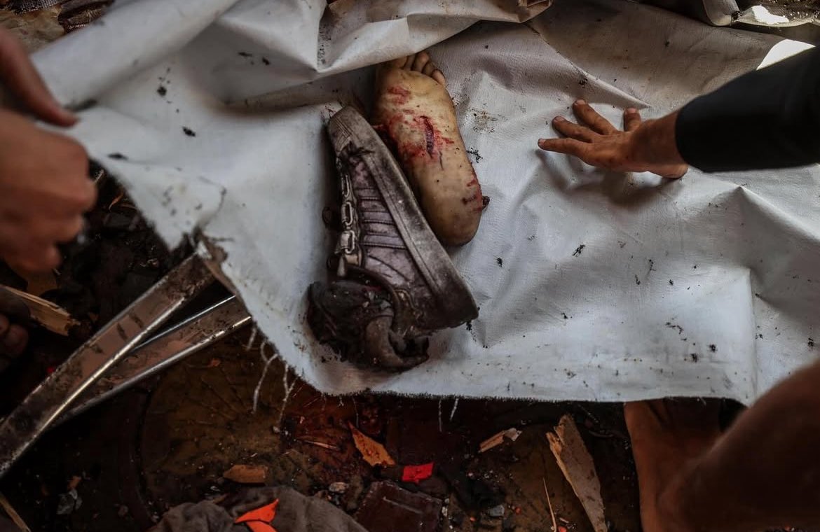 Palestinians Injured in Israeli Airstrikes on Gaza Coffee Shop
