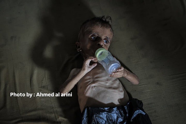 Children Starving to Death in Gaza Crisis