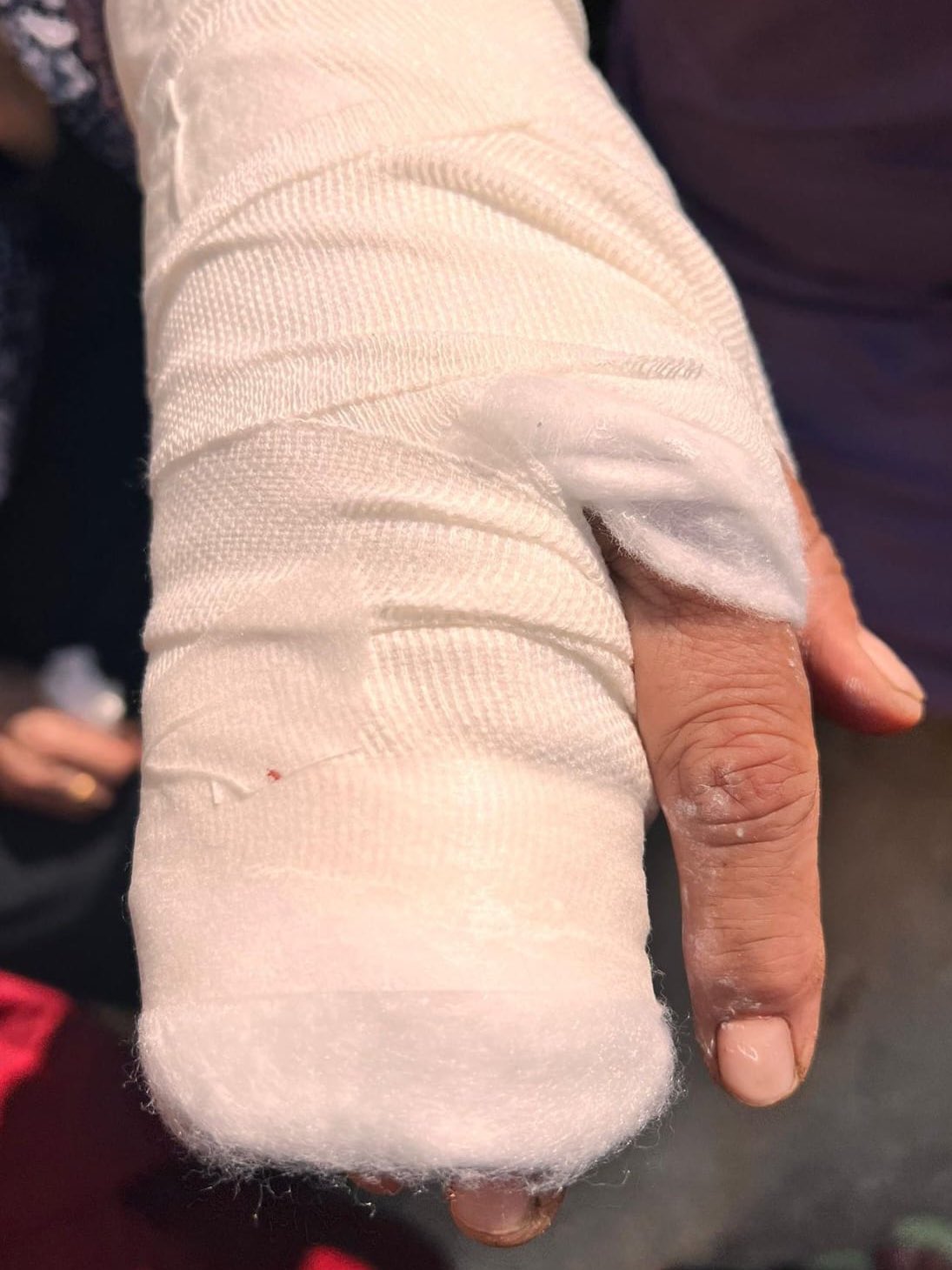 Palestinian Woman Wounded in Israeli Settler Attack West Bank