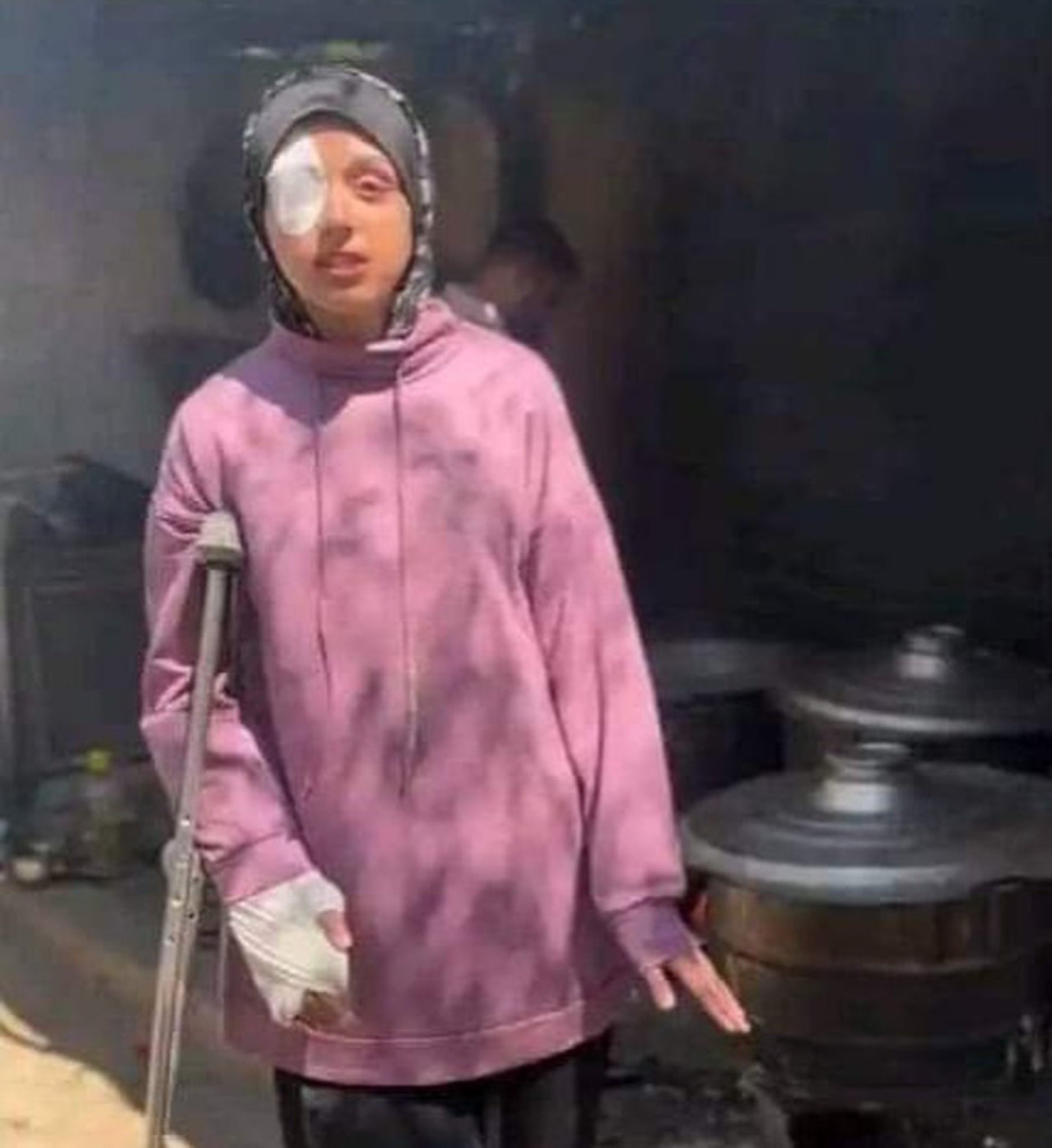 Palestinian Girl Injured in Attack Volunteers at Soup Kitchen