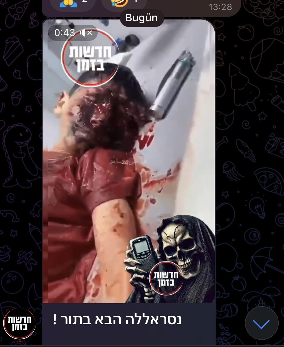Israeli channel shares images of killed Lebanese children
