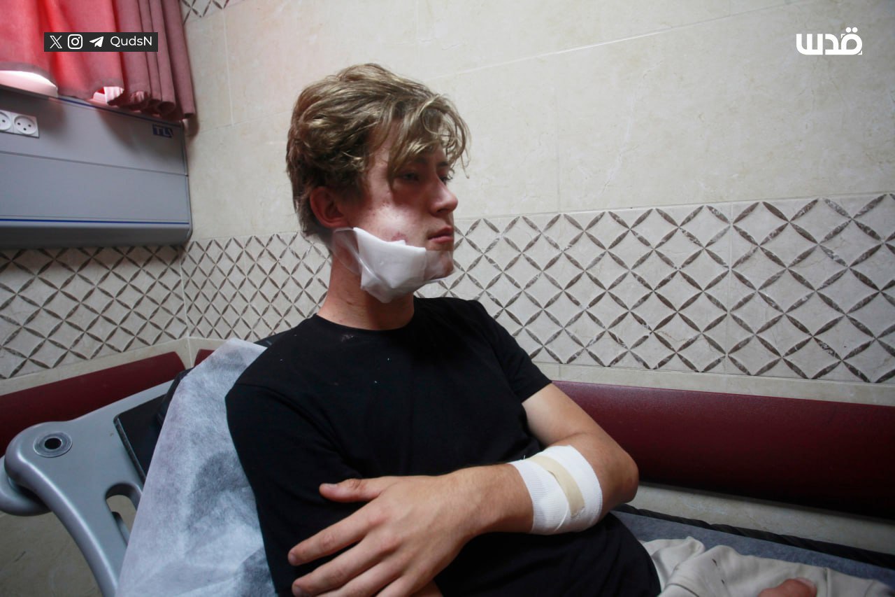 Foreign activists injured in Israeli settler attack in Qusra