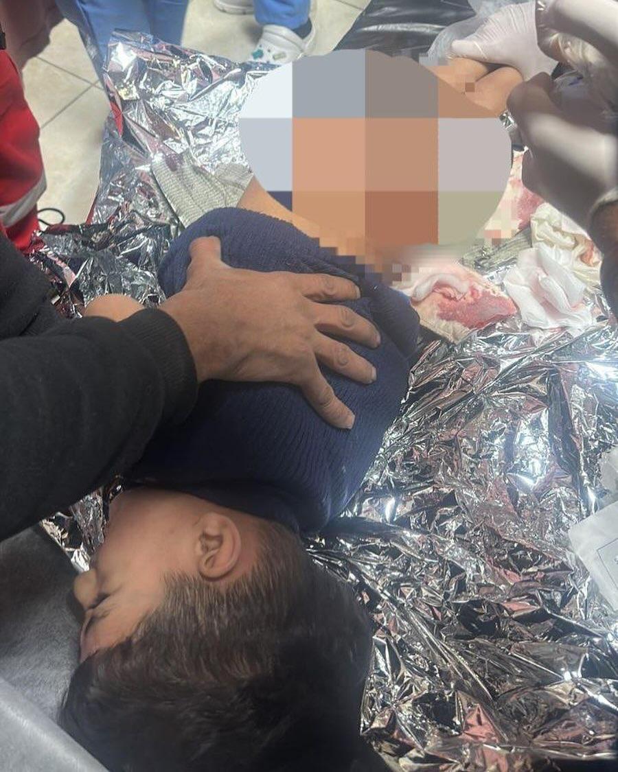 Israeli police dog injures 4-year-old Palestinian boy in Nablus